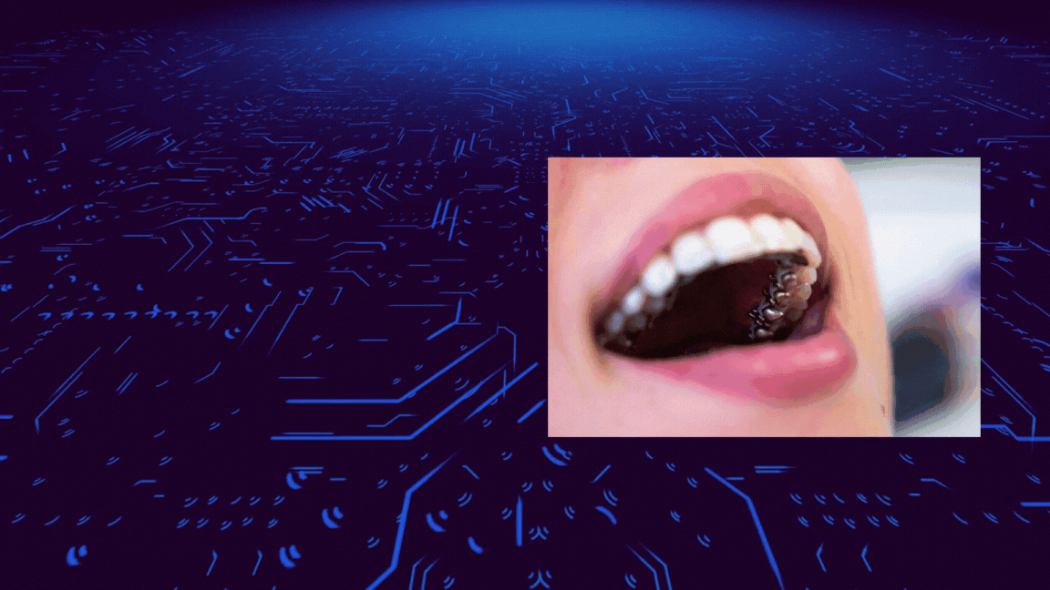 الاینرهای ارتودنسی نامرئی (Invisalign)